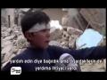 Evi Bombalanan Suriyeli Çocuğun Anlattıkları Yürek Dağlıyor